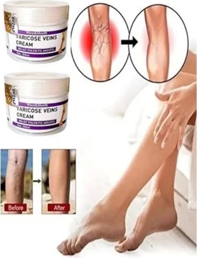 Süper V.ricose And Spider Vns Sthing Leg Cream Bacak Bakım Kremi 100 ml x 2 Adet