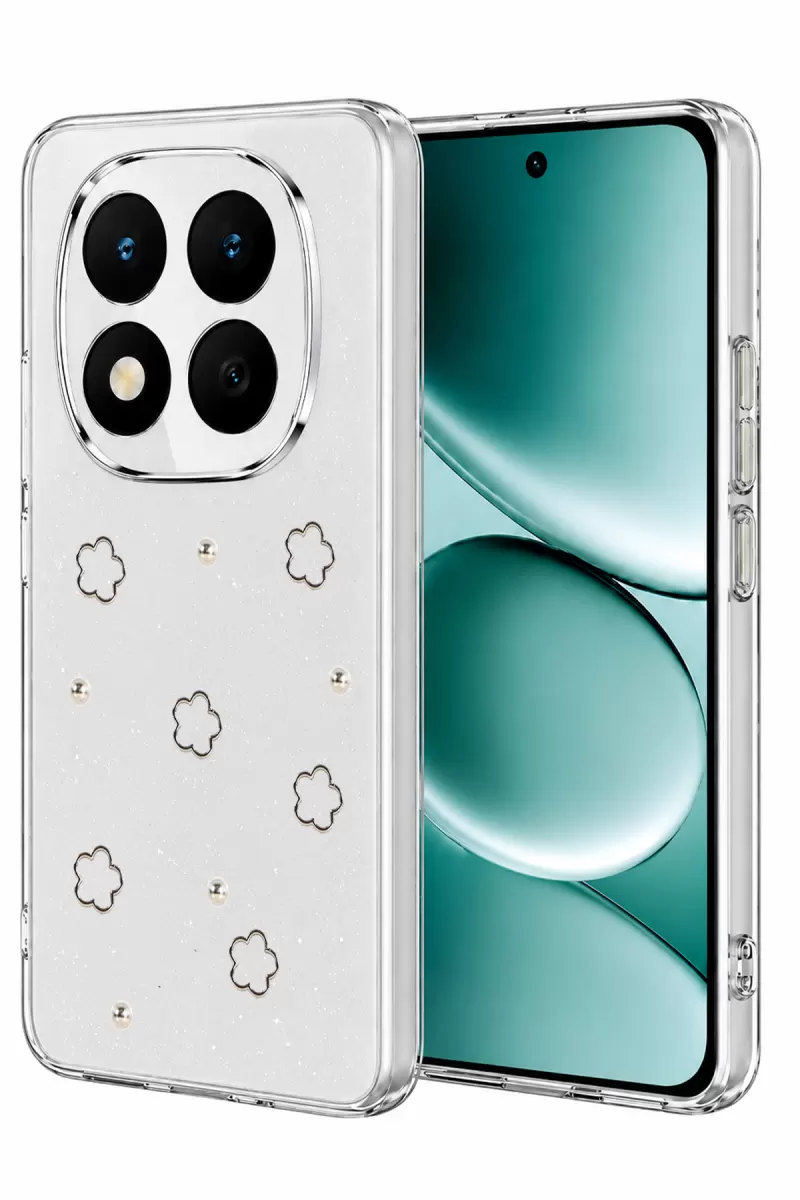 Note 15 Pro Plus 5G Fiyonk Desenli Kapak - Desen 2