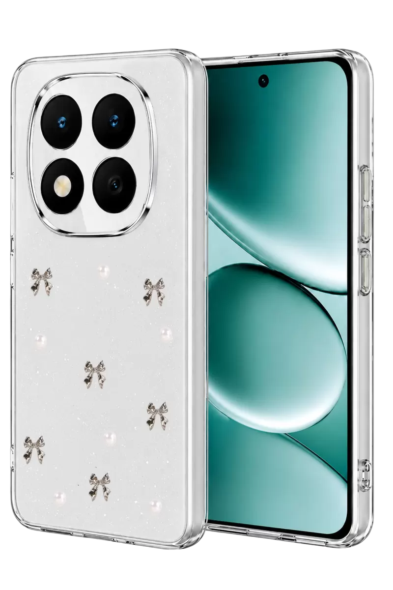 Note 15 Pro Plus 5G Fiyonk Desenli Kapak - Desen 8