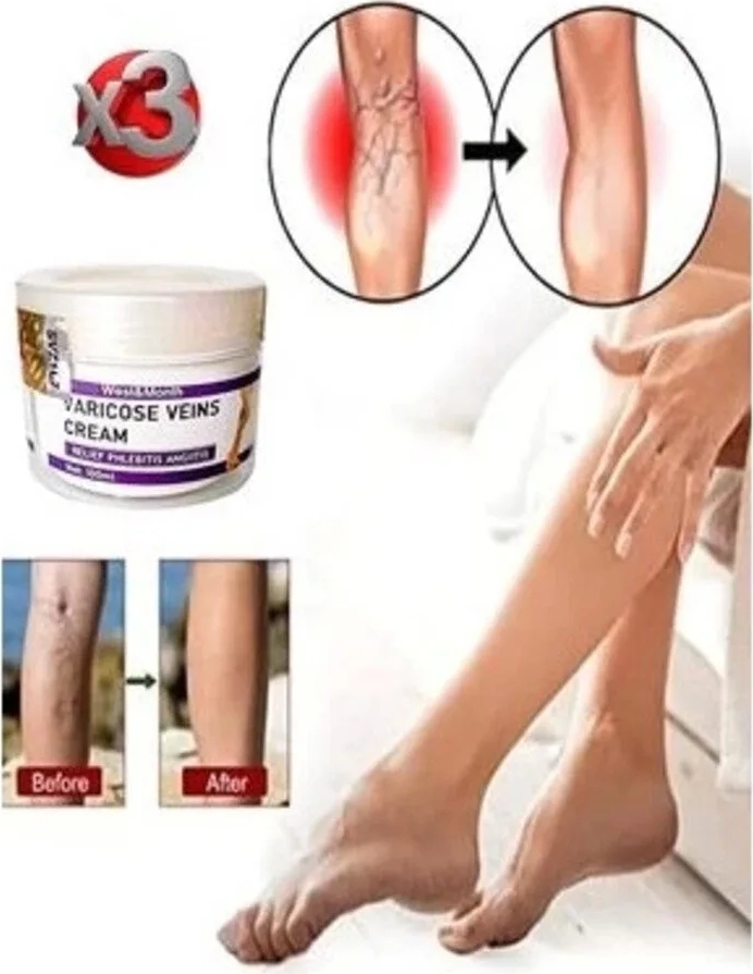 Süper V.ricose And Spider Vns Sthing Leg Cream Bacak Bakım Kremi 100 ml x 3 Adet