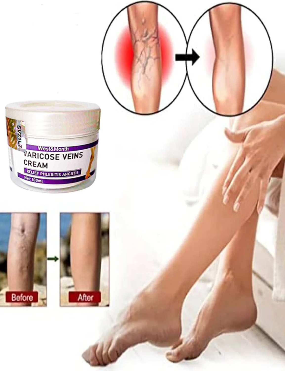 V.ricose And Spider Vns Sthing Leg Cream Bacak Bakım Kremi 100 ml