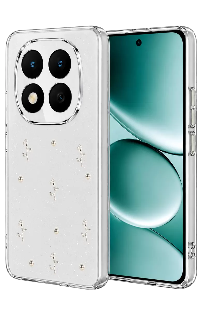 Note 15 Pro Plus 5G Fiyonk Desenli Kapak - Desen 4