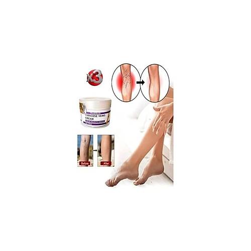 Varicose And Spider Veins Soothing Leg Cream Bacak Bak�m Kremi 100 ml x 3 Adet