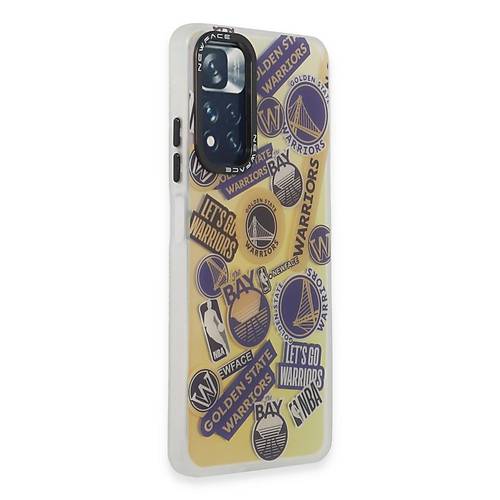 Redmi Note 11 Pro K�l�f Estoril Desenli Kapak - Estoril - 13