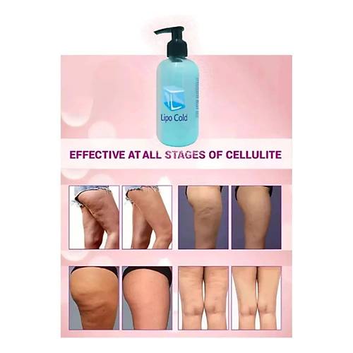 Lipo Cold S�k�l��a Inceli�e Hafifli�e Ve Sel�lilitlerinize G��l� Etkide Krem 250 ml X 2 ADET