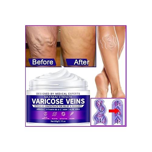 Maximum Strength Varicose Veins Krem 100 ml 1 Adt