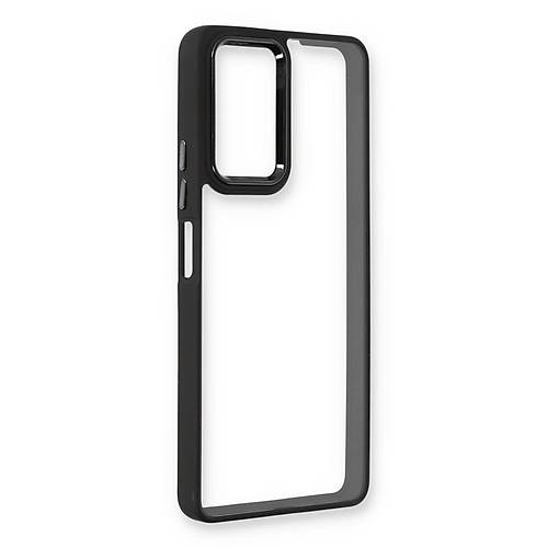 Redmi Note 11 Pro K�l�f Dora Kapak - Siyah