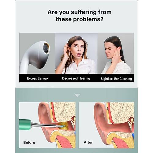 BEBIRD T5 3MP KAMERA 3.5MM LENS �ARJLI WIFI G�R�NT�L� KULAK TEM�ZLEY�C� YE��L RENK