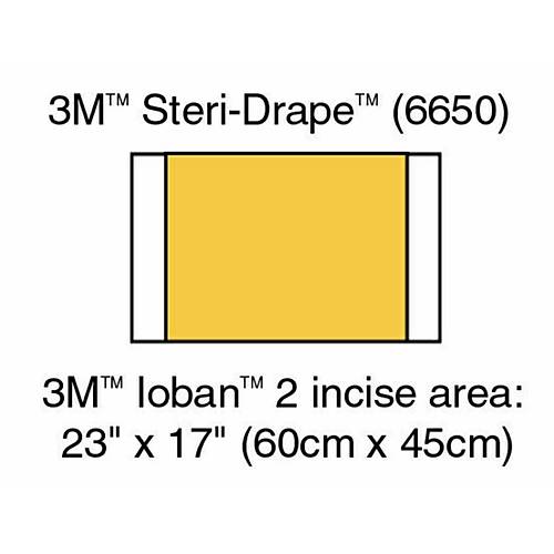 Ioban 2 - Antimikrobiyal �nsizyon �rt�s� - 56 cm x 45 cm