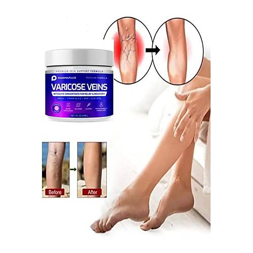 Maximum Strength Varicose Vein Var.is Bacak Bak�m Masaj Kremi 100 ml 2 Adet