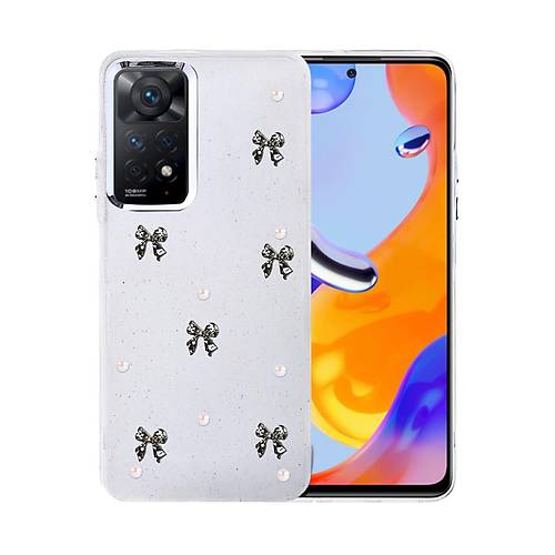 Redmi Note 11 Pro Fiyonk Desenli Kapak - Desen 8