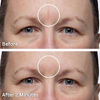 DERMAFLAGE  KIT  ( iz, �ukur, yara silikon kapat�c� )