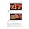 G�rsel 35