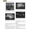 G�rsel 55