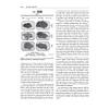 G�rsel 70