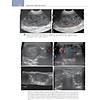 G�rsel 30