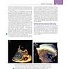G�rsel 35