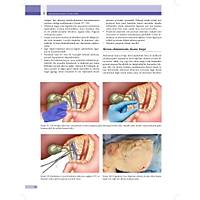 KED� ve K�PEKLERDE CERRAH� AC�LLER (Tan�dan Tedaviye)