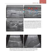 K���K HAYVAN D�AGNOST�K ULTRASON (4. Bask�)<p>Toplam 265 adet Video